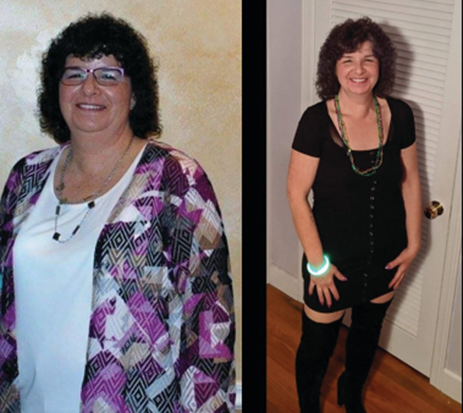 Amy Bernard, seen in these before and after pictures, is the 2019 Queen of Oakland Beach Chapter 44 of Taking Off Pounds Sensibly, or TOPS.